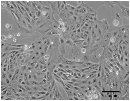 A kind of preparation method of the avian influenza virus grown in the mdck cell growth of serum-free full suspension culture and the avian influenza virus obtained