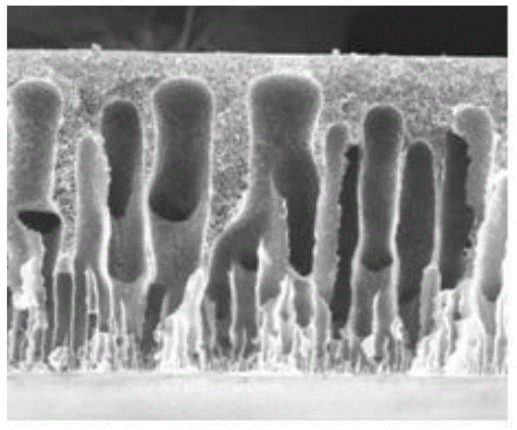 Bio-adhesion-resistant porous separation membrane as well as preparation method and application thereof