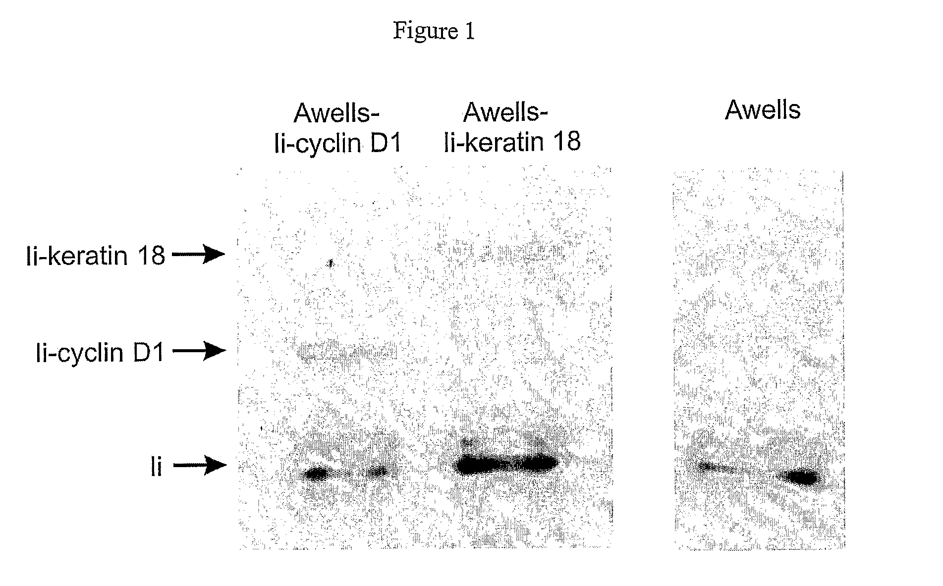 Immunogenic T-Helper Epitopes From Human Tumour Antigens and Immunotherapeutic Methods Using Said Epitopes