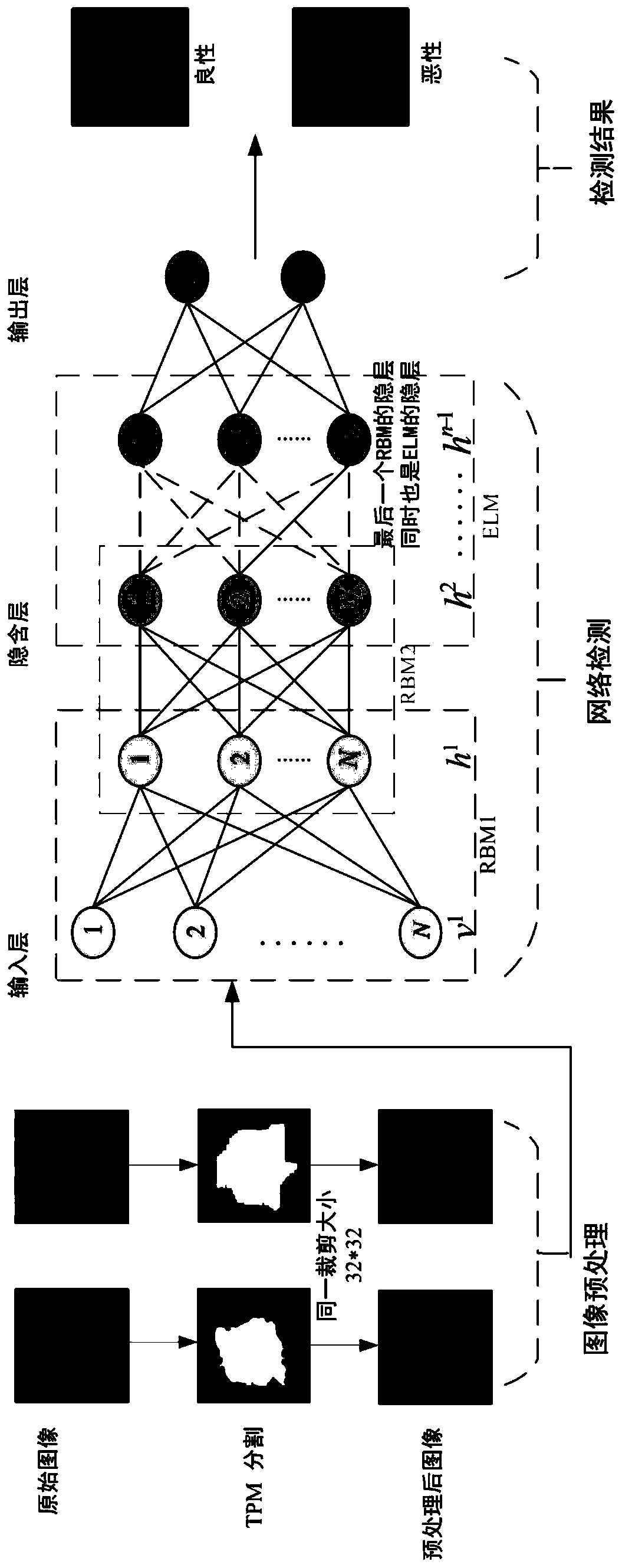 A feature extraction method for pulmonary nodules based on an improved deep Boltzmann machine