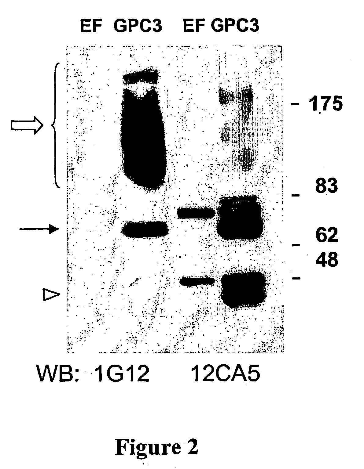 Diagnosis of hepatocellular carcinoma