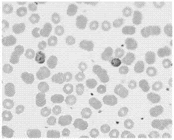 A rapid and sensitive method for the detection of Plasmodium malariae