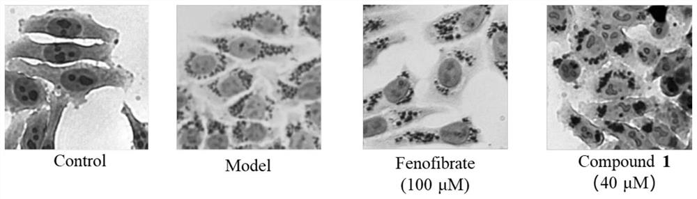 Selenium-containing chalcone derivative compound 1, its synthesis method and its application in anti-nonalcoholic steatohepatitis drugs