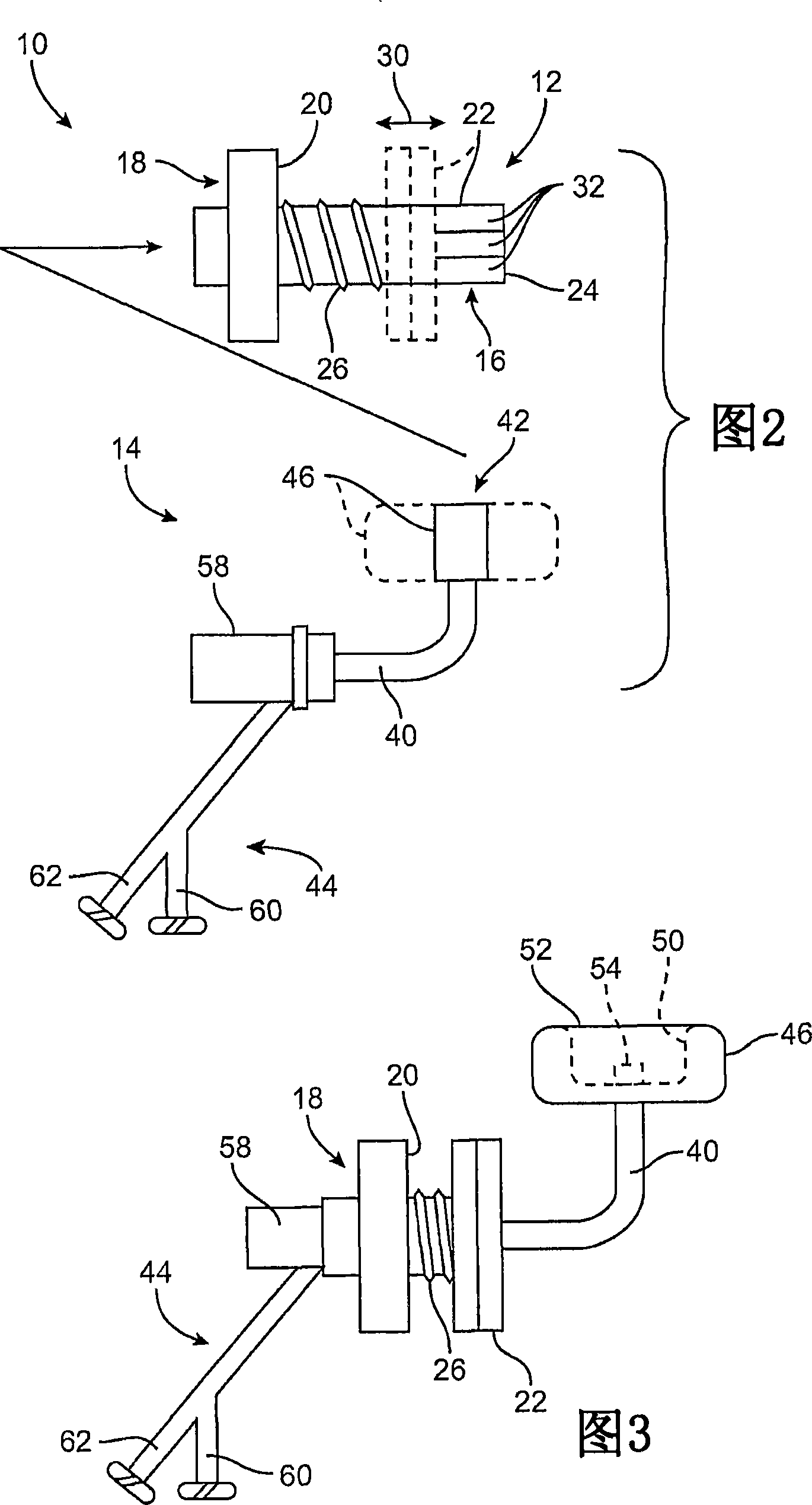 Methods and systems for tracheal access and ventilation