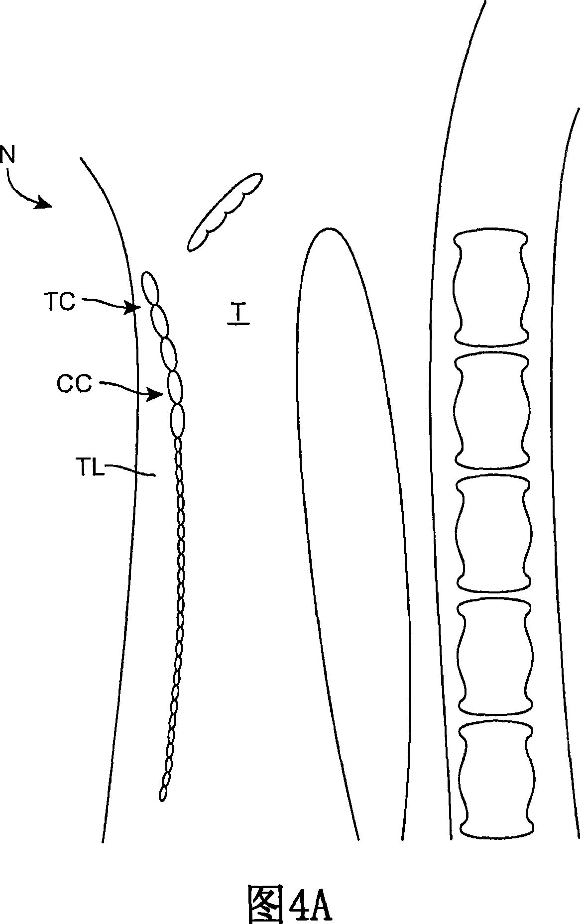 Methods and systems for tracheal access and ventilation