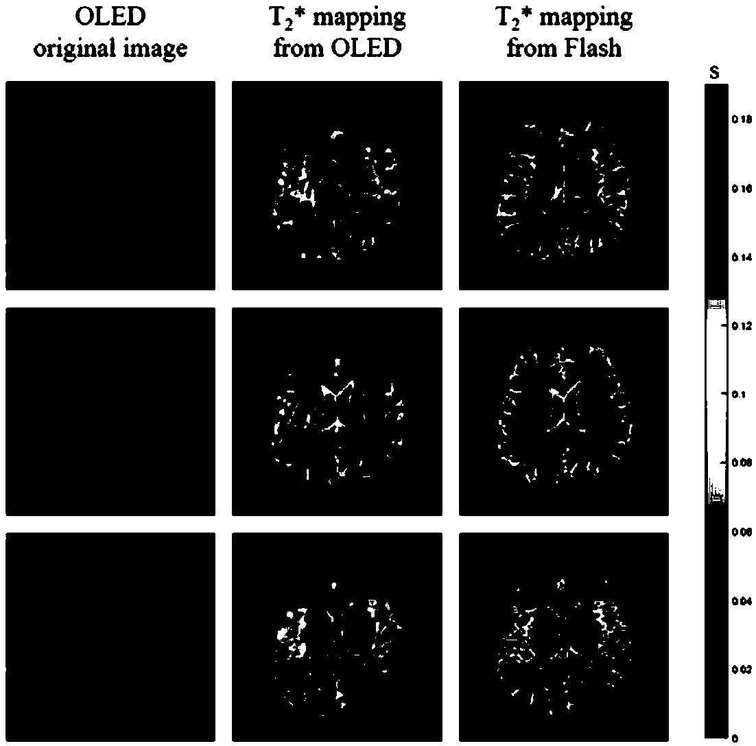 Single-scanning quantitative magnetic resonance T2 * imaging method based on residual network reconstruction