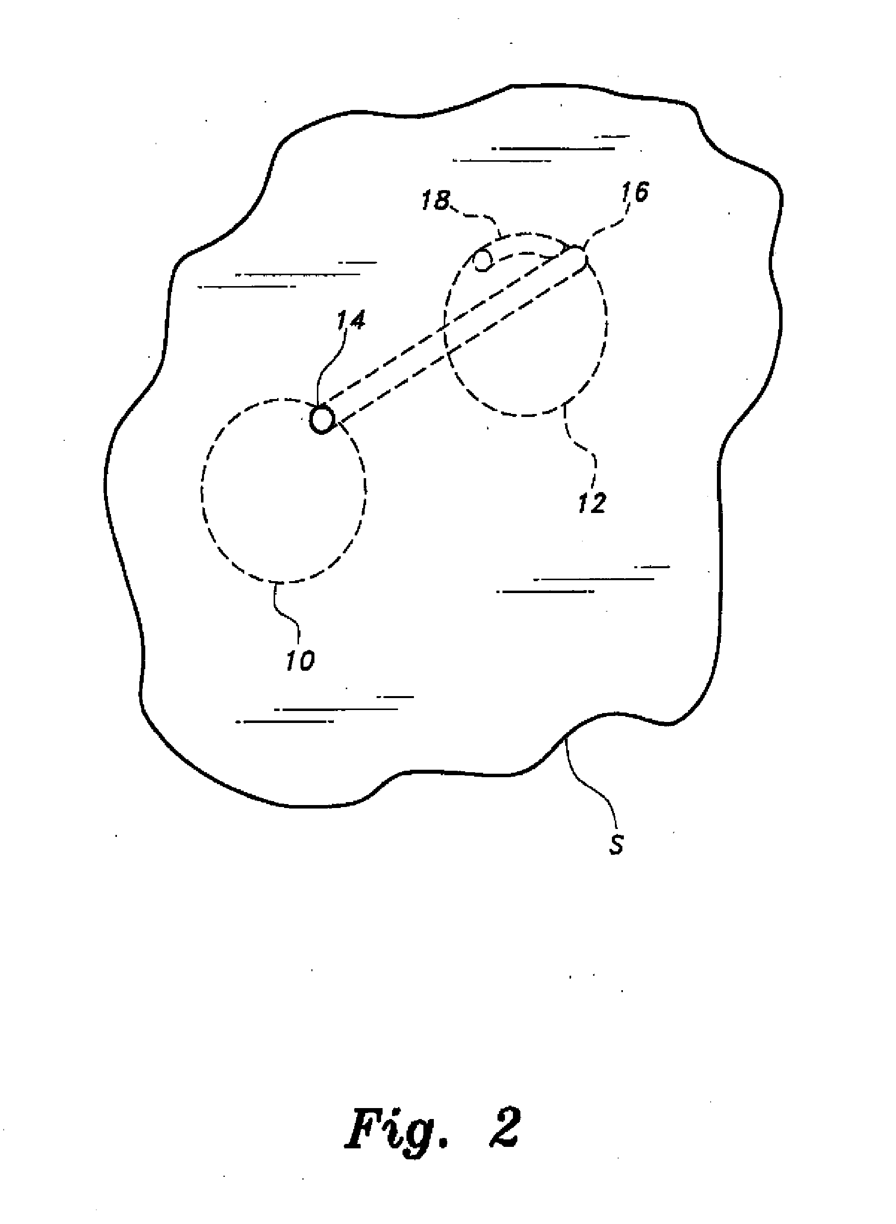 Method for wire saw excavation