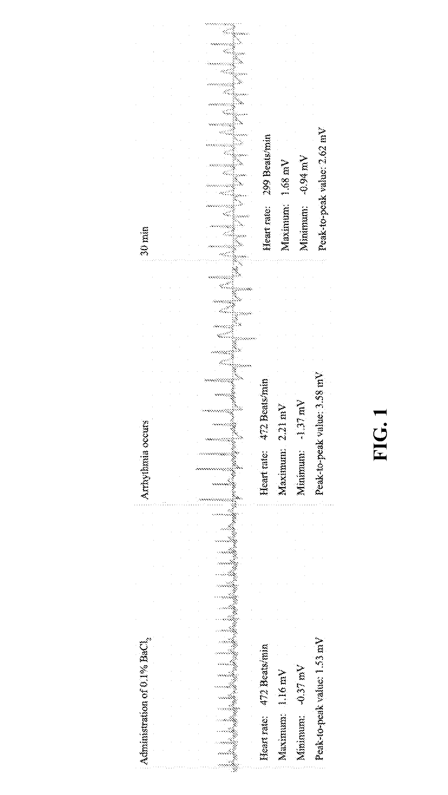 7,2''-dehydrate puerarin and its salts, preparation method and use thereof