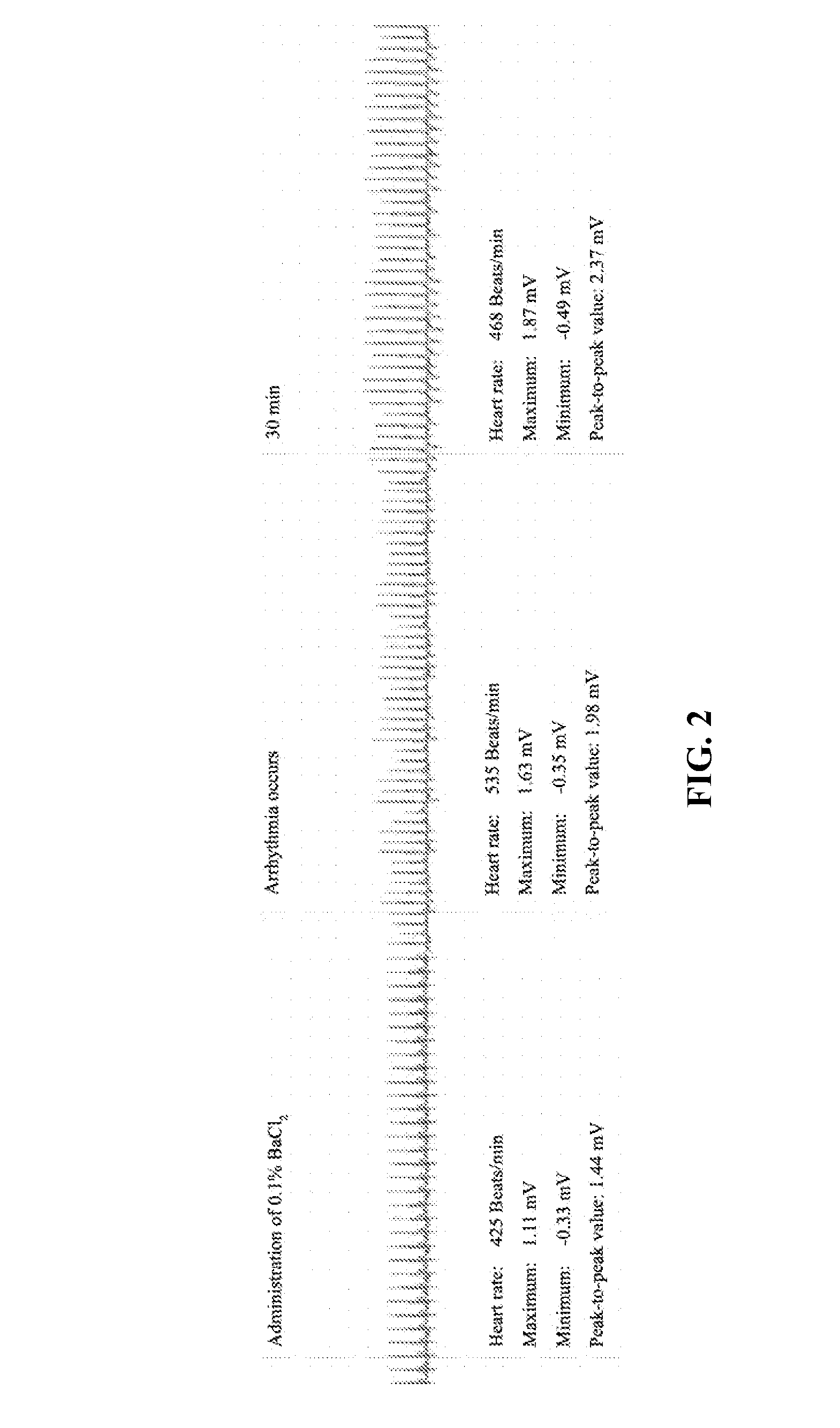 7,2''-dehydrate puerarin and its salts, preparation method and use thereof