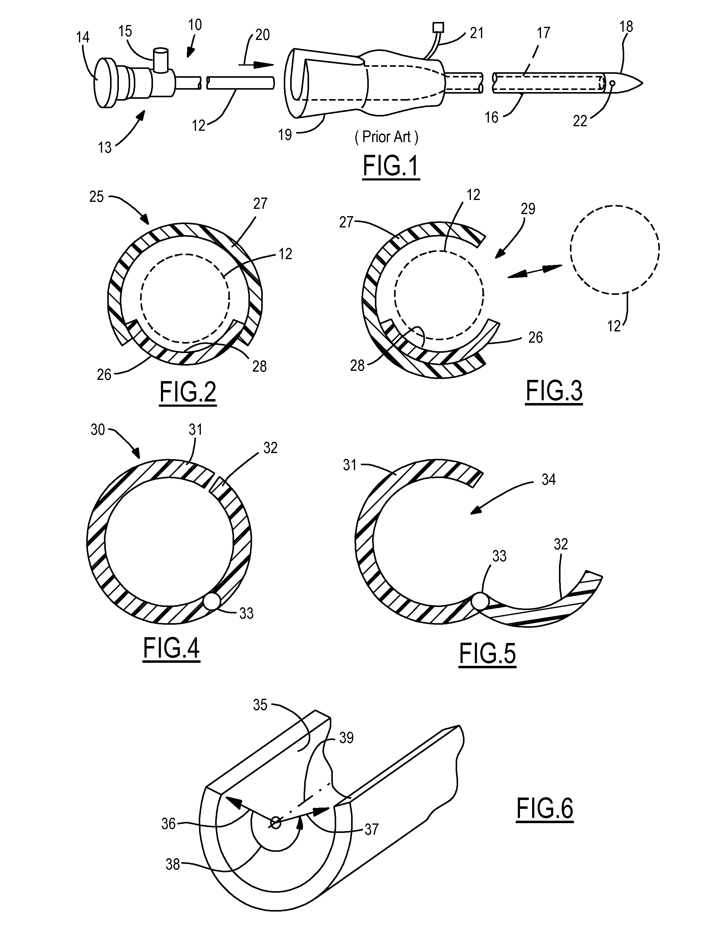 Endoscopic Vessel Dissector With Side Entry