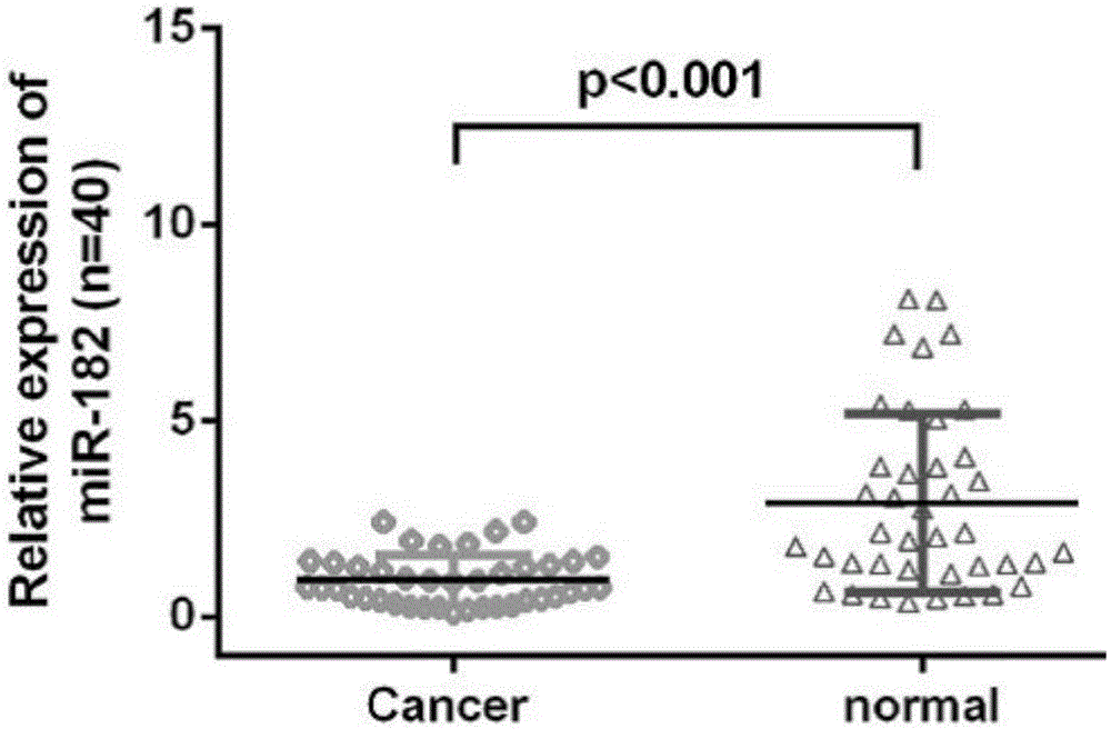 MiR-182 transcription inhibition factor and application of miR-182 transcription inhibition factor to osteosarcoma