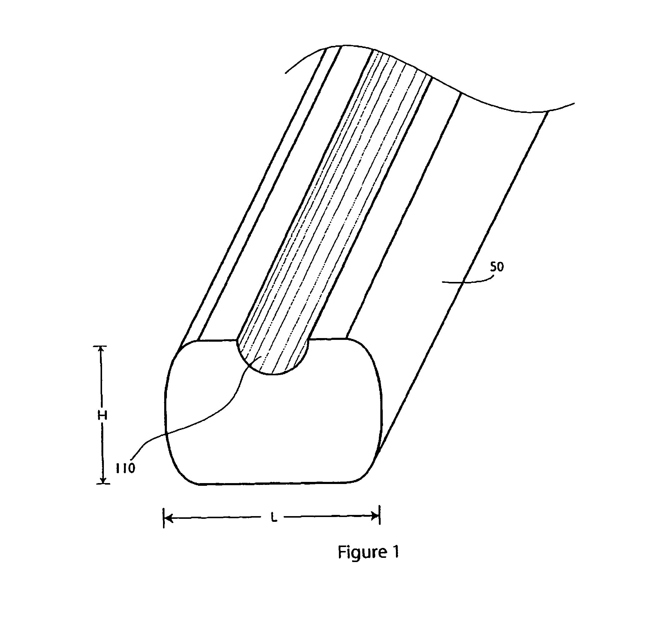 Surgical staple