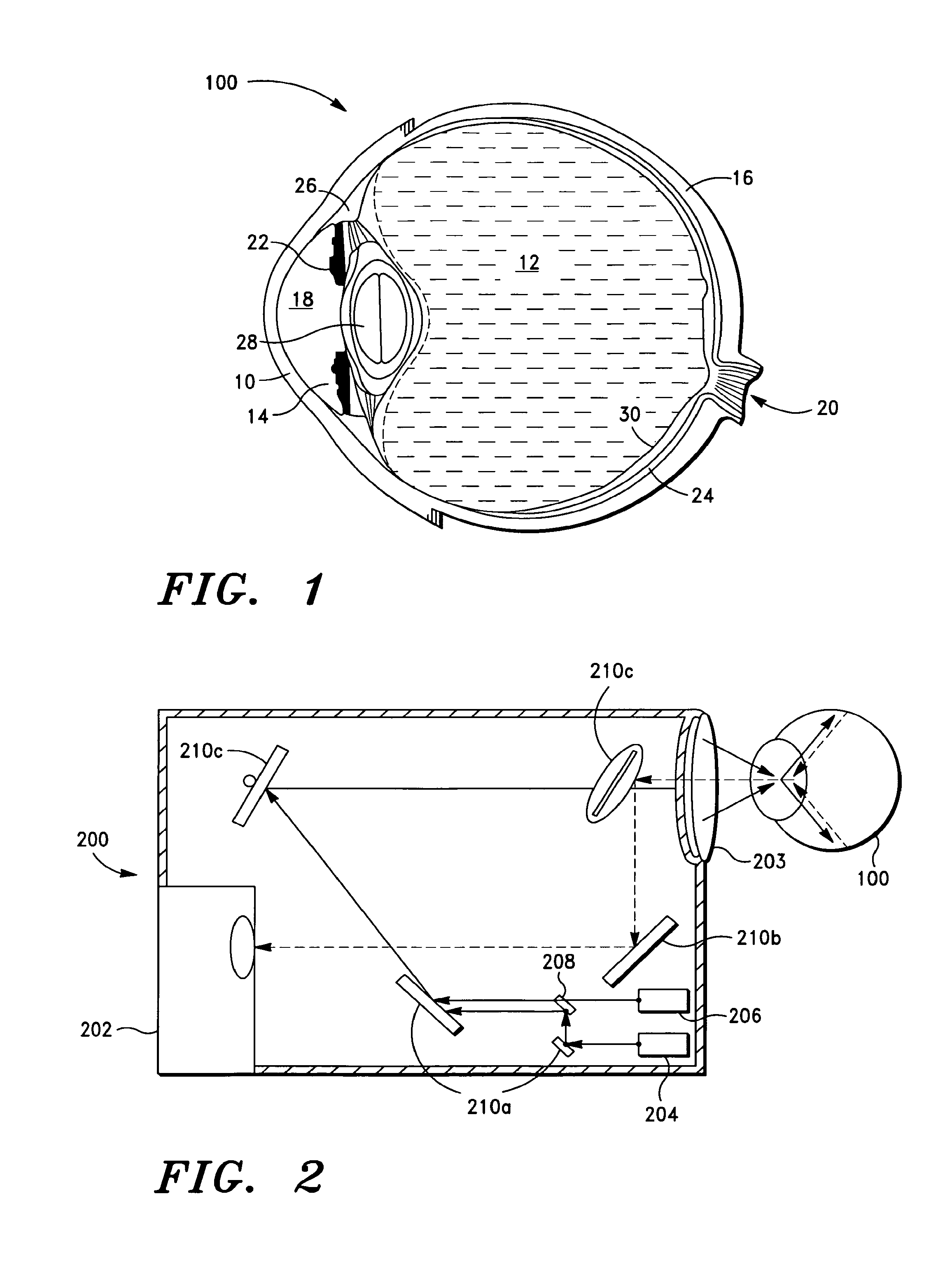 Laser coagulation of an eye structure or a body surface from a remote location