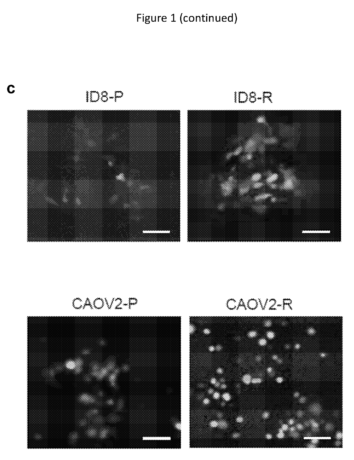 Methods and compositions for cancer therapy