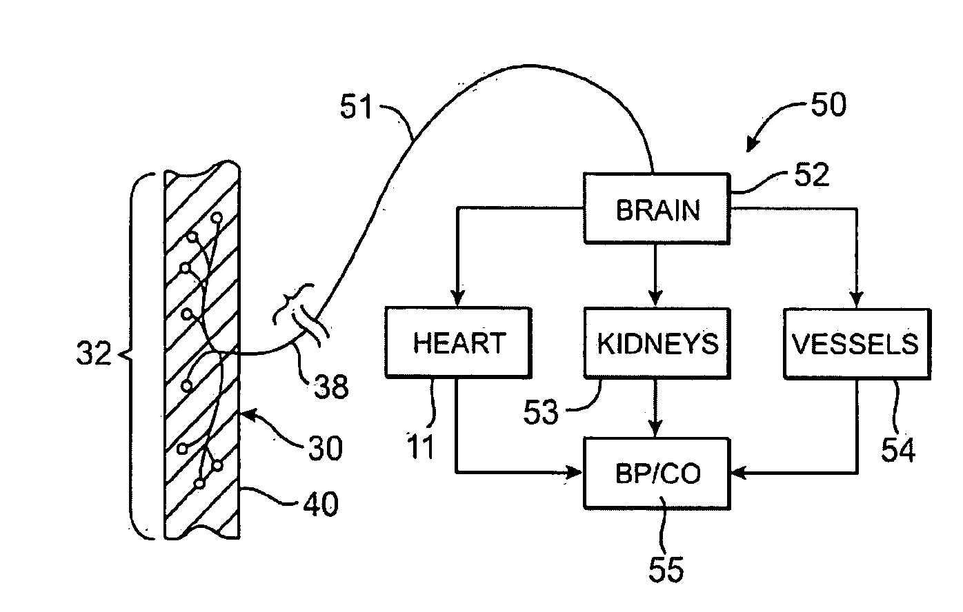 External Baroreflex Activation