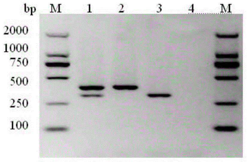 Multiplex DPO-PCR (dual-priming oligonucleotide-polymerase chain reaction) detection kit for sunflower white rust and black stem and application thereof