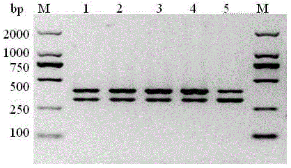 Multiplex DPO-PCR (dual-priming oligonucleotide-polymerase chain reaction) detection kit for sunflower white rust and black stem and application thereof