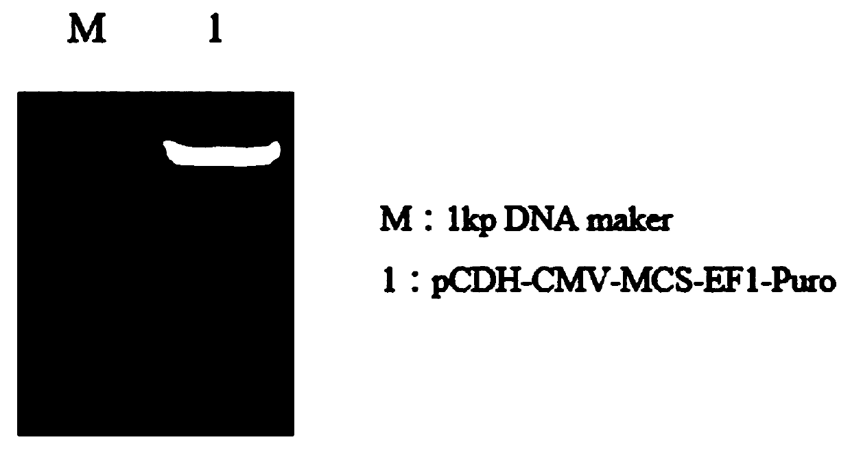 Preparation and construction method of CAR-T carrier applied in colon cancer treatment