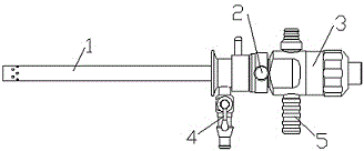 Kidney stone clearing operation sheath