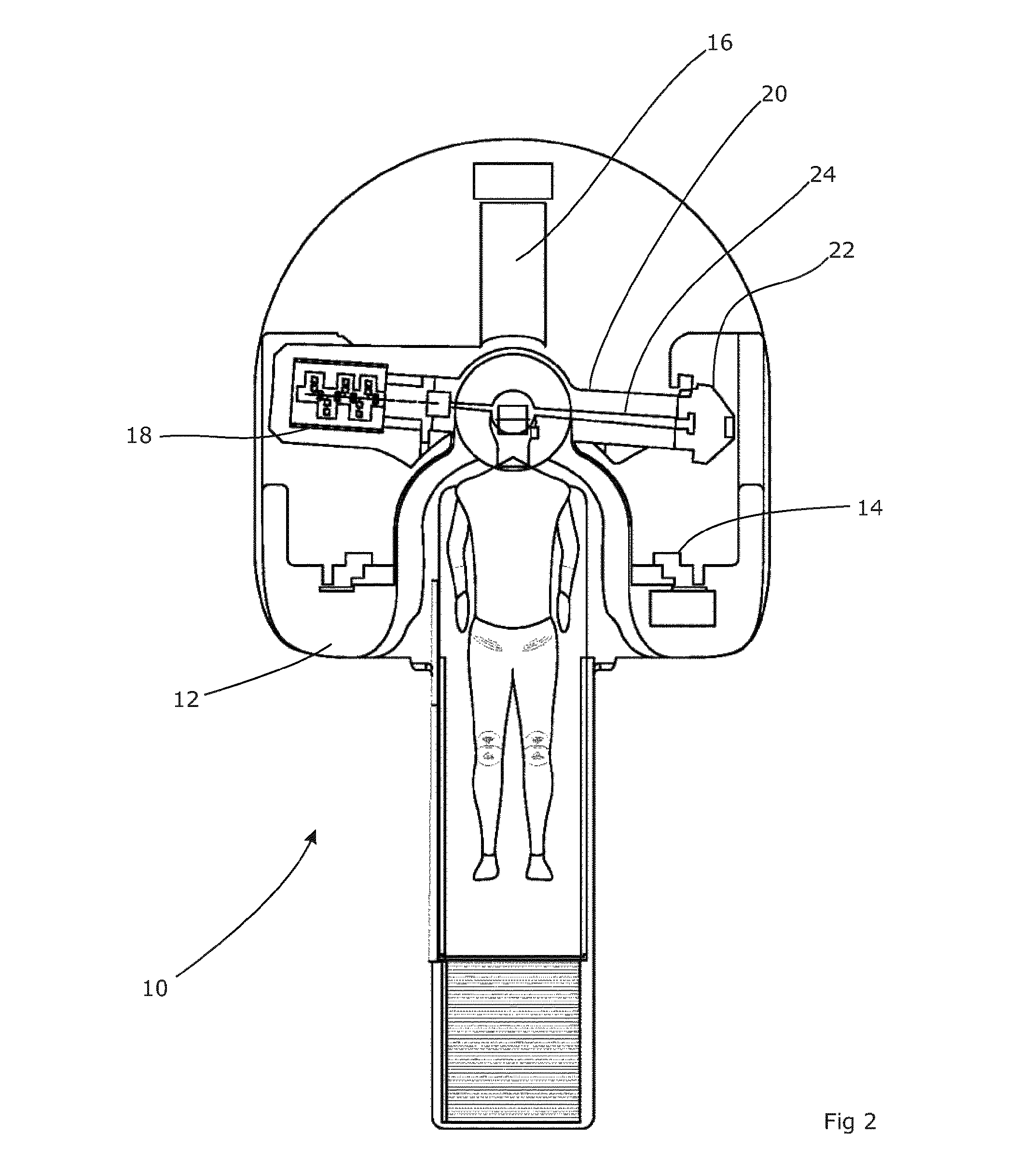 Image guided radiotherapy