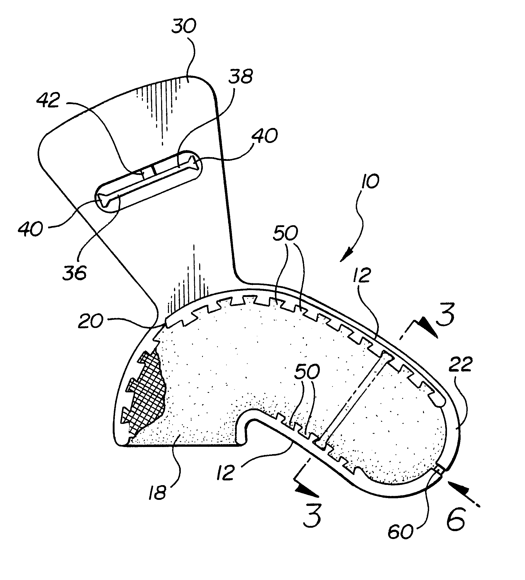 Dental impression tray