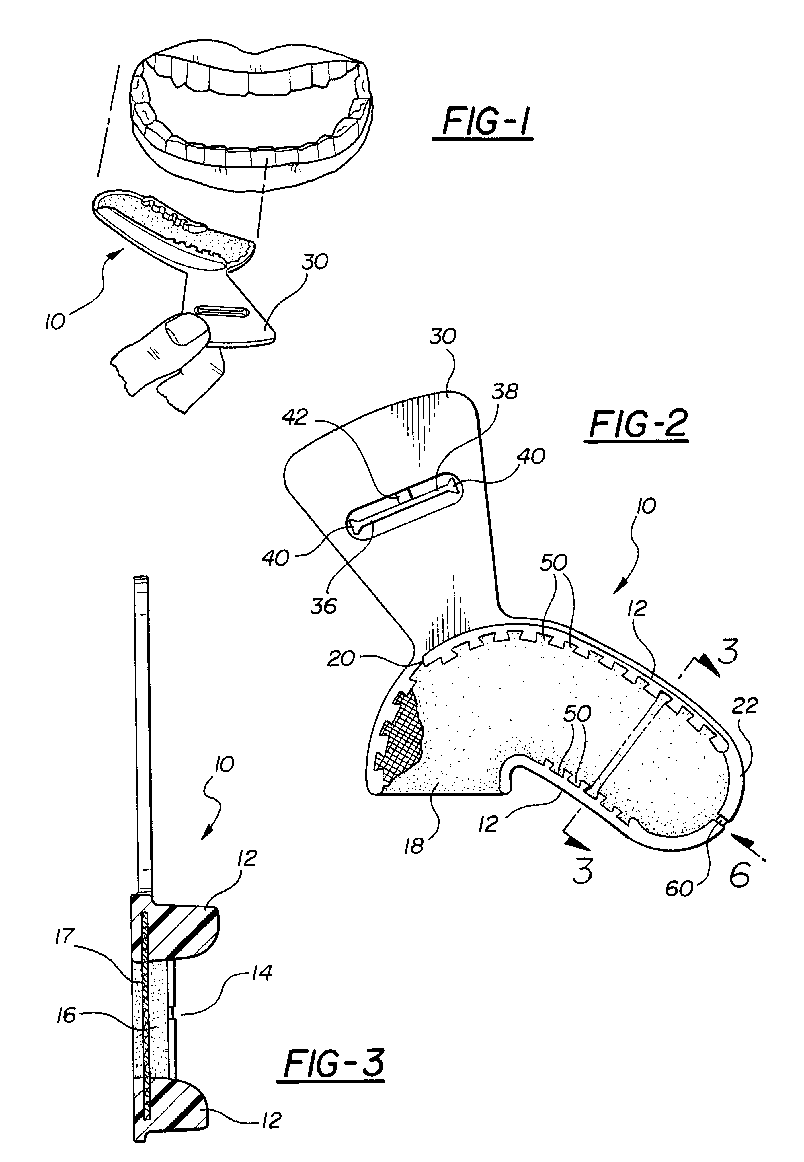 Dental impression tray