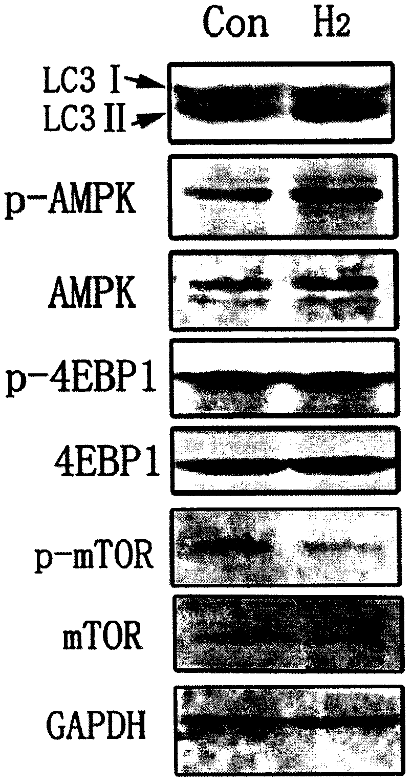 Specification for hydrogen treatment of reperfusion injury of dermal microvascular endothelial cells