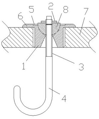 Artificial clavicle coracoid joint capable of resetting and fixing acromioclavicular joint