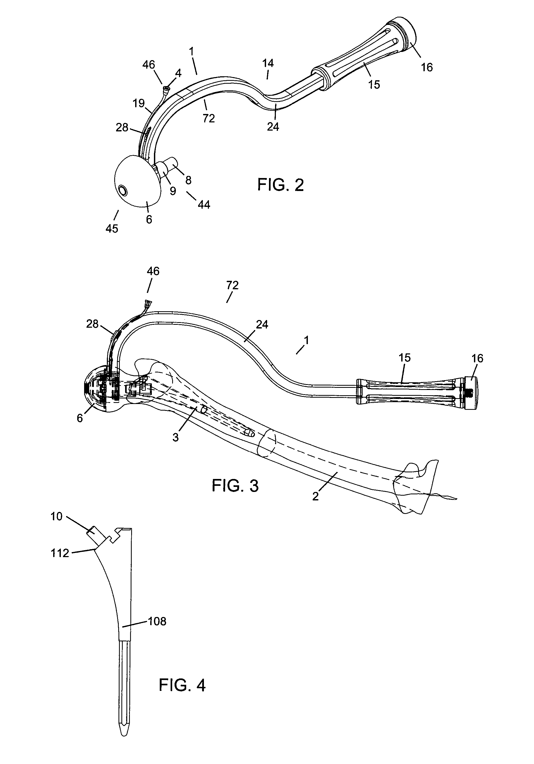 Apparatus and method for sculpting the surface of a joint