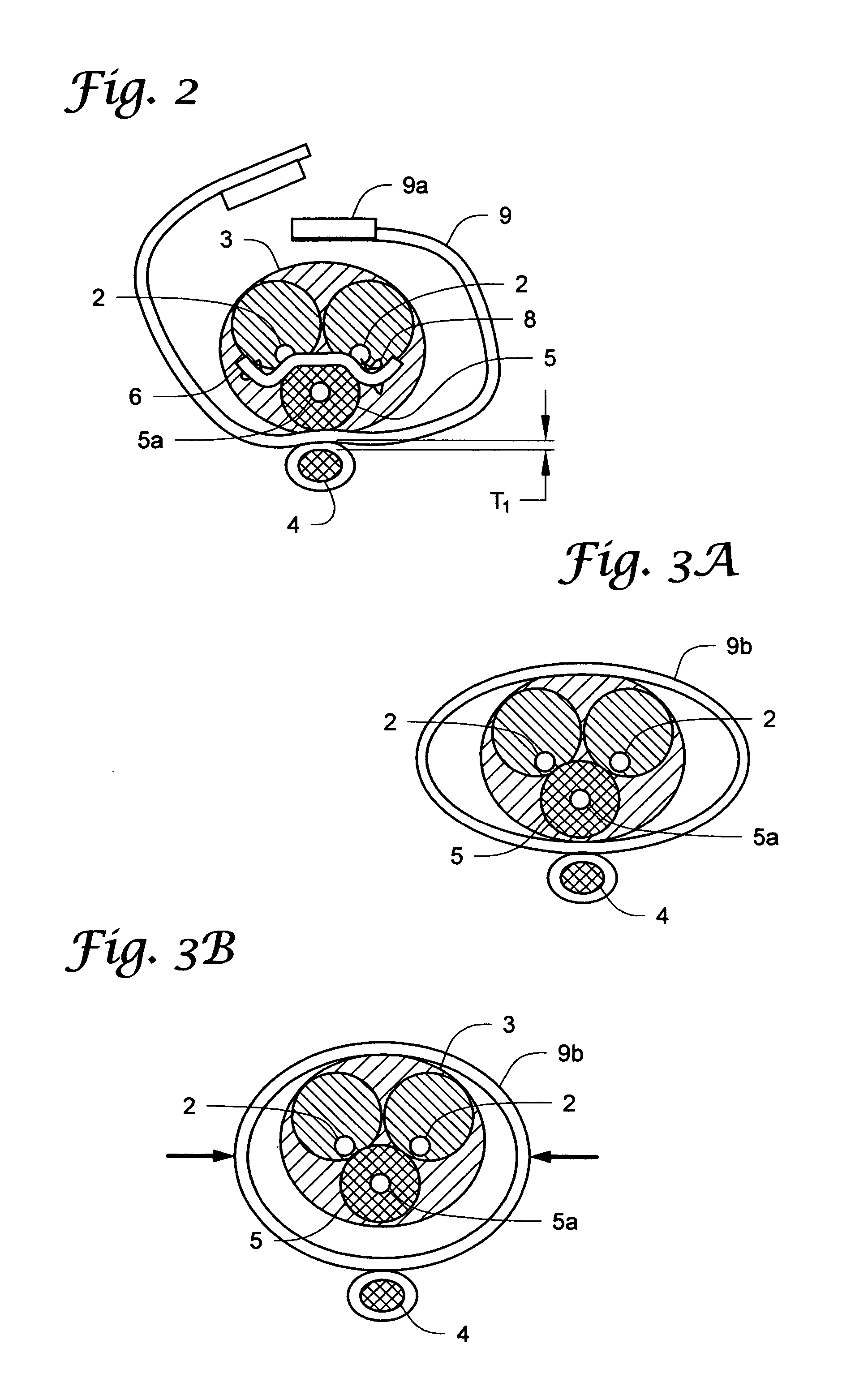 Urethral occlusive assembly for preventing urinary incontinence