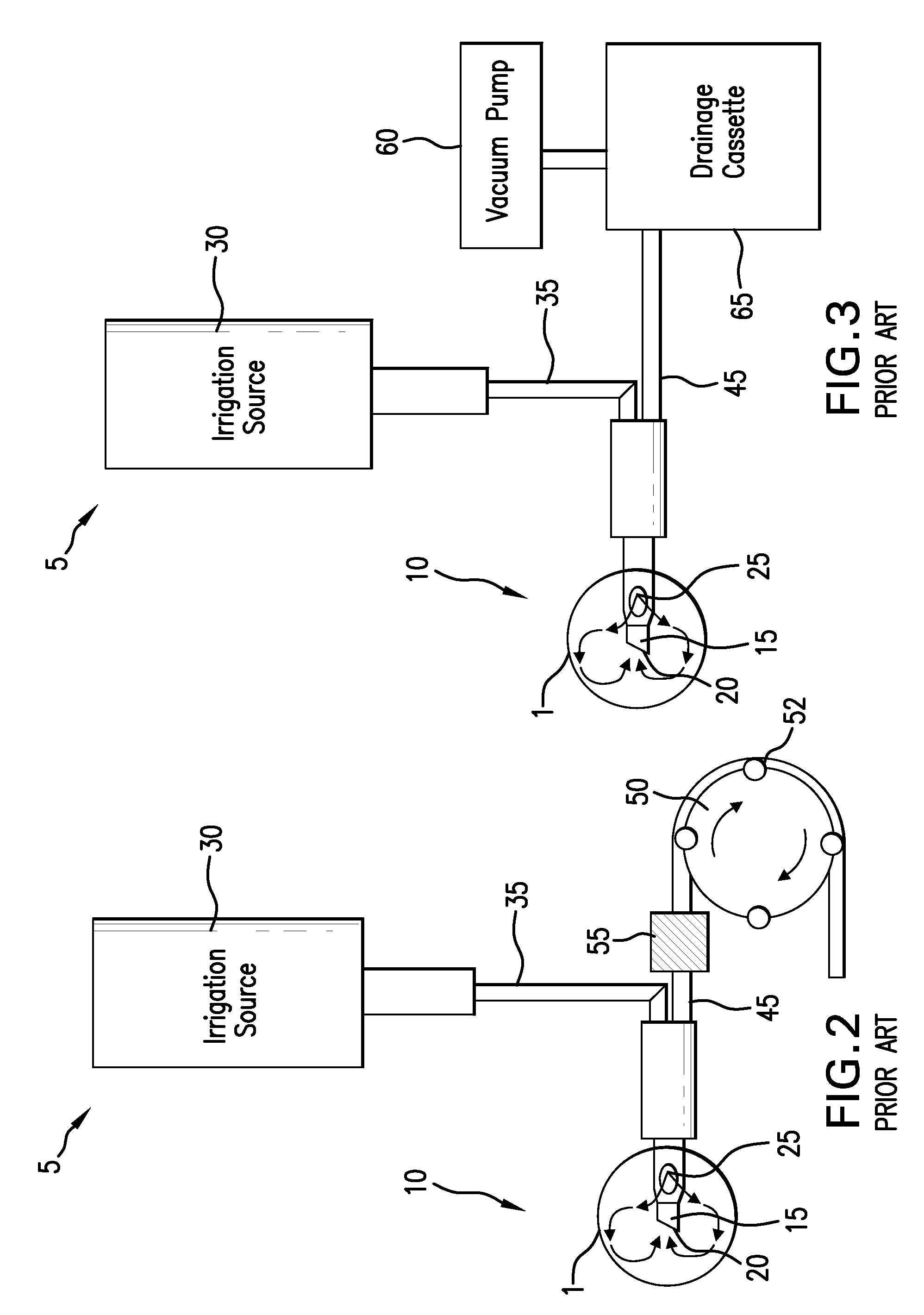 Systems and methods for phacoemulsification with vacuum based pumps