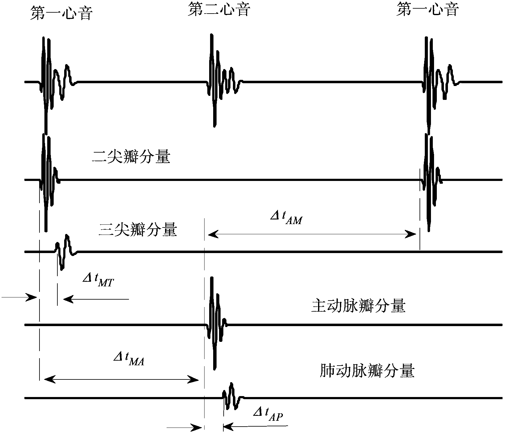 Pulmonary circulation blood pressure monitoring equipment based on body surface phonocardiogram and method for monitoring pulmonary circulation blood pressure by using equipment