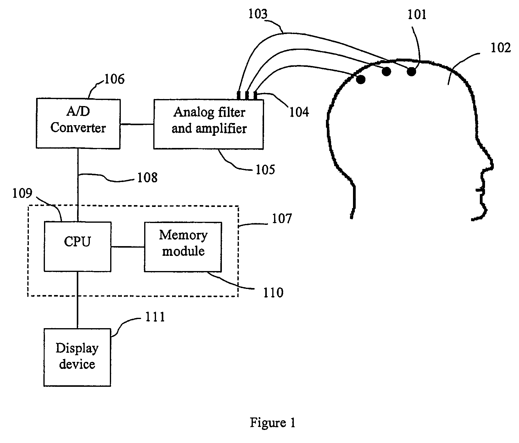 Method of monitoring brain function