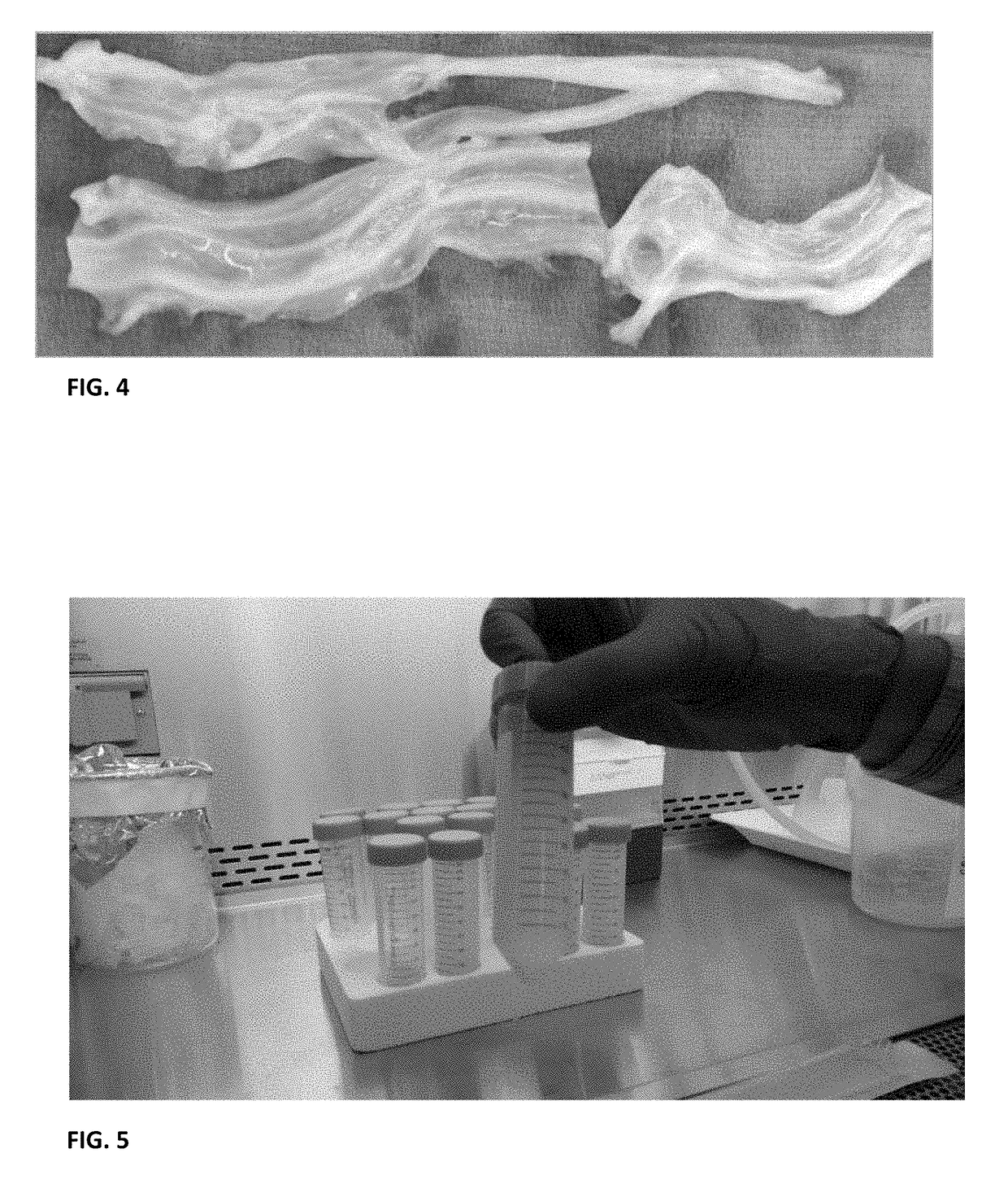 Acellular biologic composition and method of manufacture