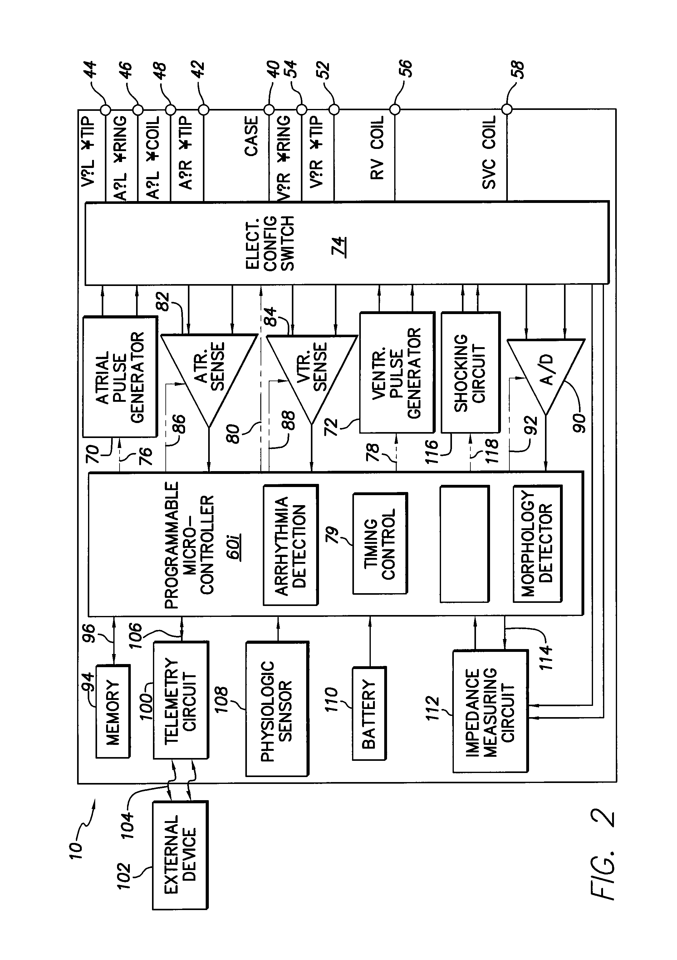 Subcutaneous cardiac stimulation device providing Anti-tachycardia pacing therapy and method