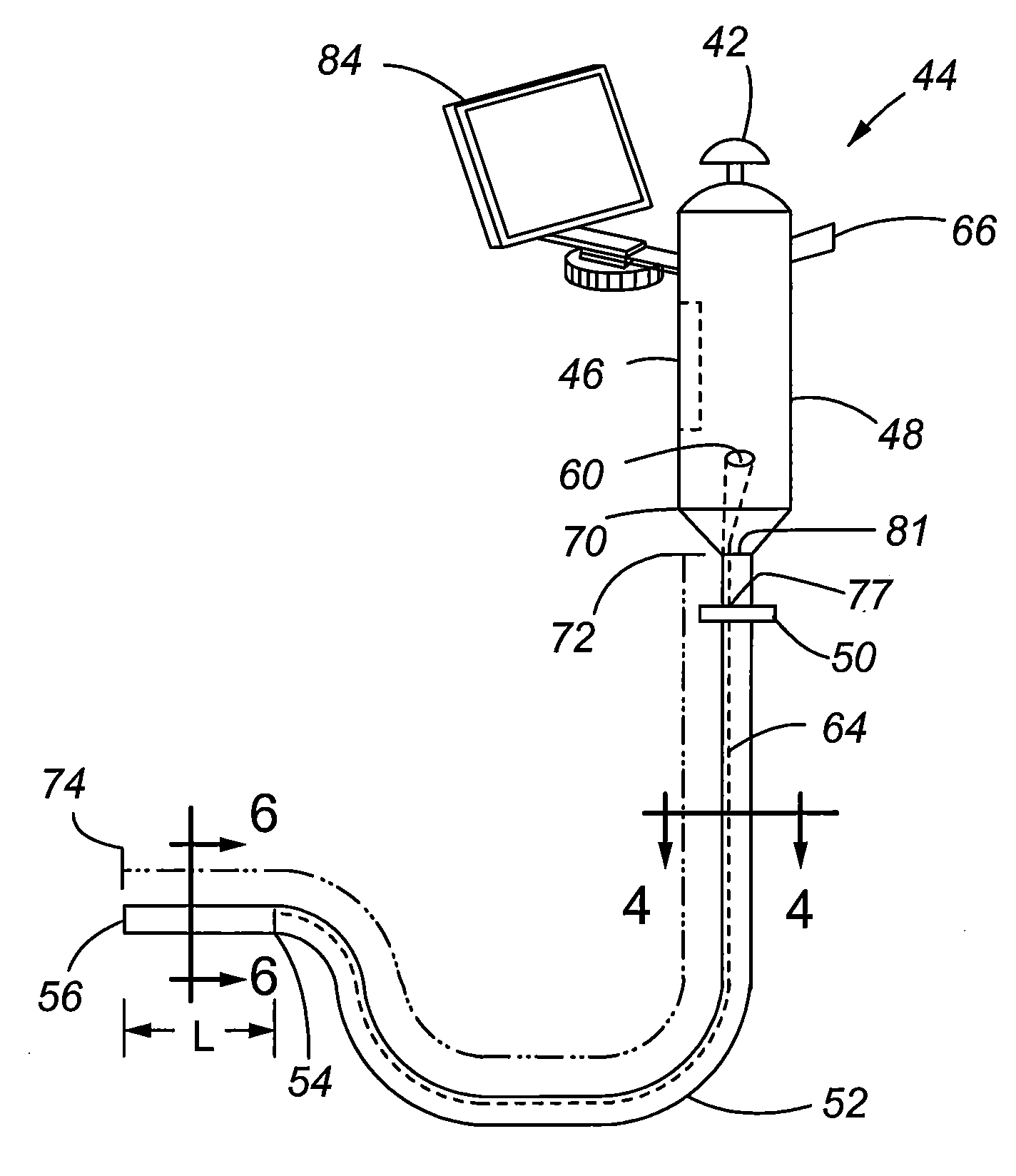 Scope for managing difficult pathways and method to improve visibility of the same