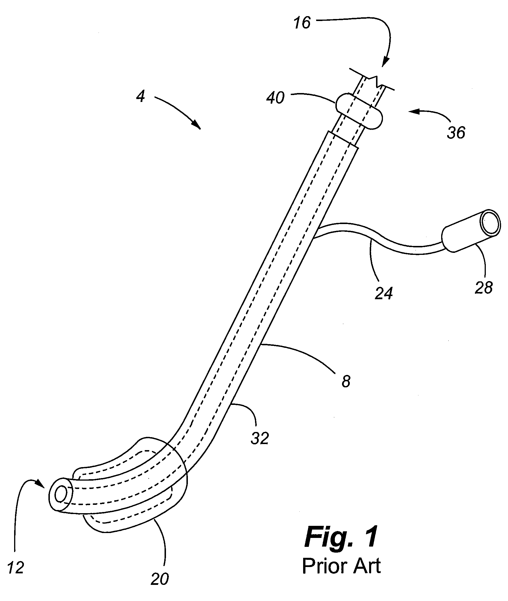 Scope for managing difficult pathways and method to improve visibility of the same