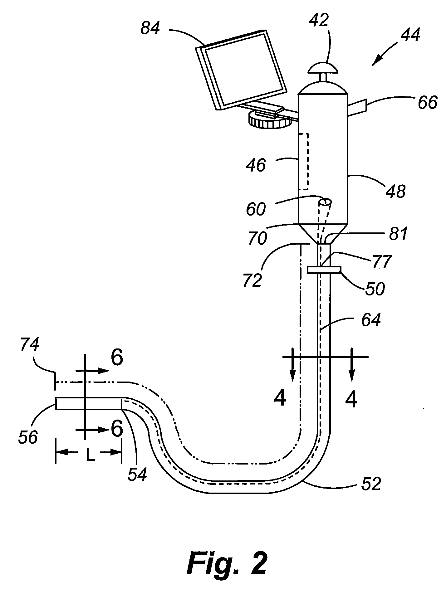 Scope for managing difficult pathways and method to improve visibility of the same