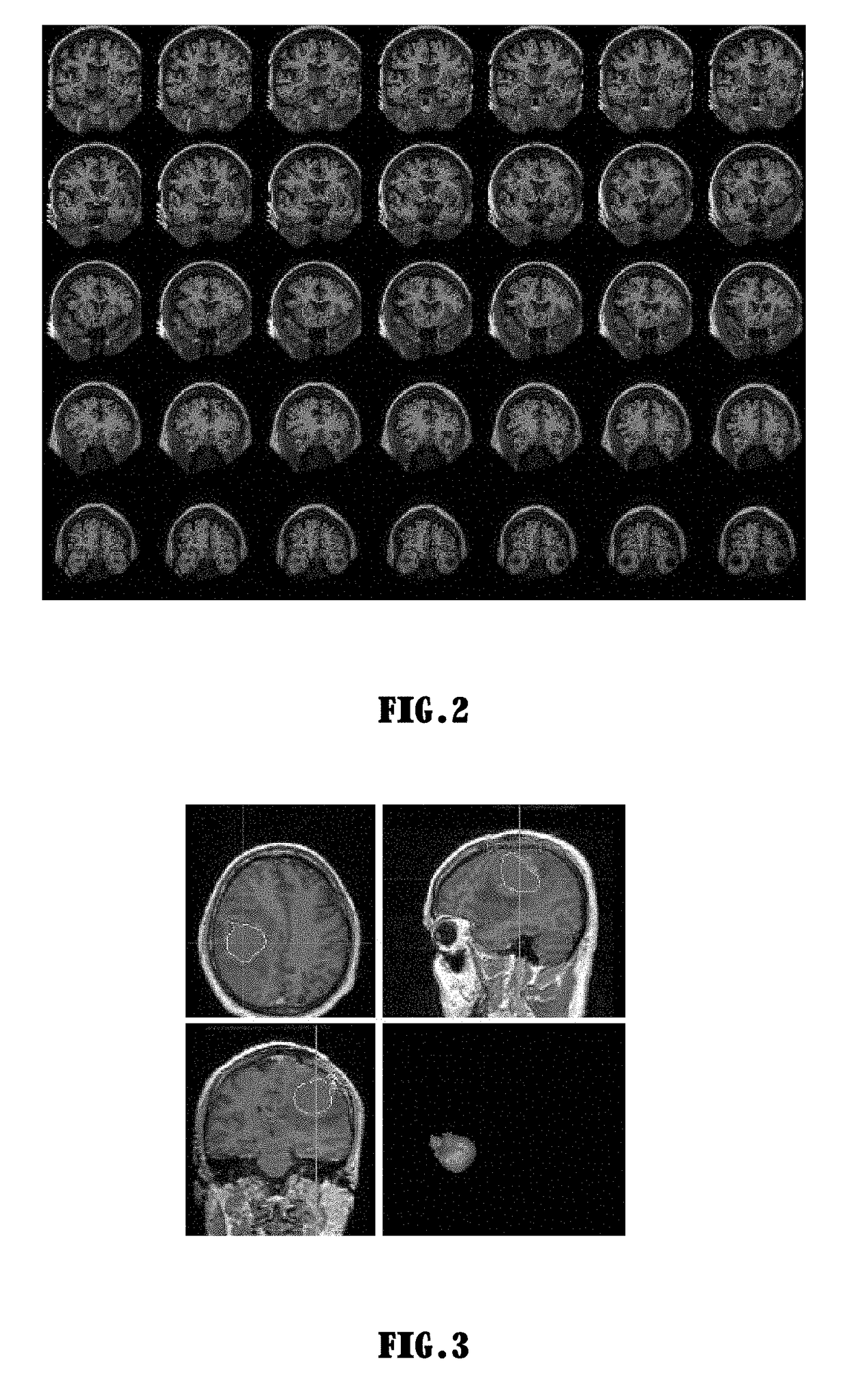 Method For Analysing Medical Treatment Data Based On Deep Learning and Intelligence Analyser Thereof