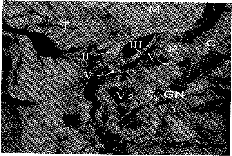 Human embryonic trigeminus based three-dimensional reconstruction method by using slide stainer