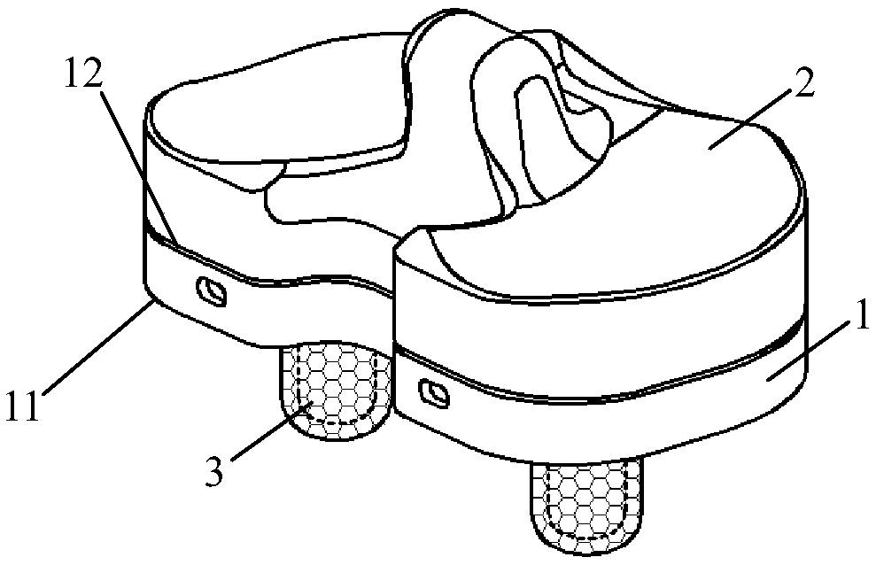 Uncemented tibial component of trabecular structure and making method of uncemented tibial component