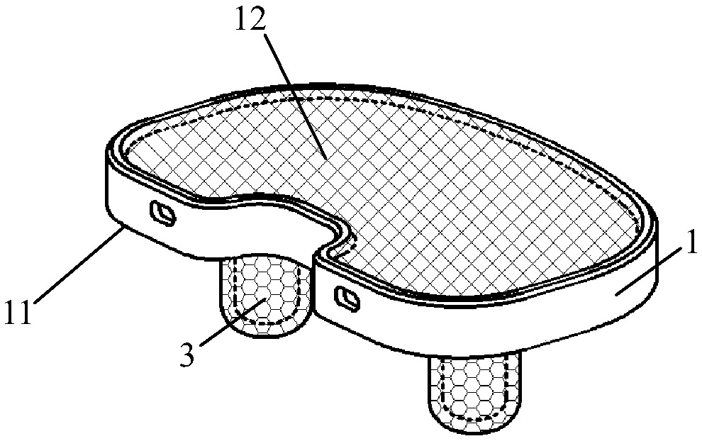 Uncemented tibial component of trabecular structure and making method of uncemented tibial component