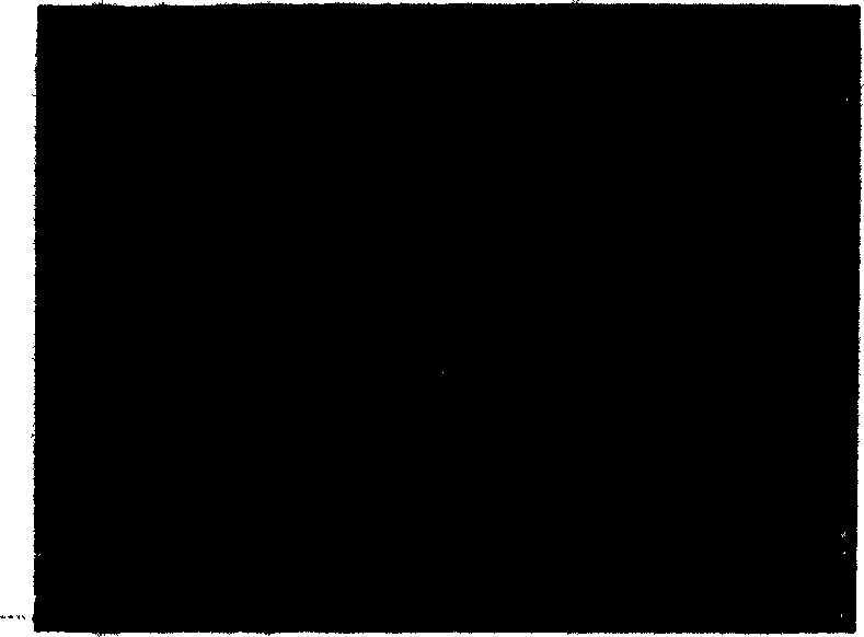 Method for separating and purifying stem cell of skin epidemis