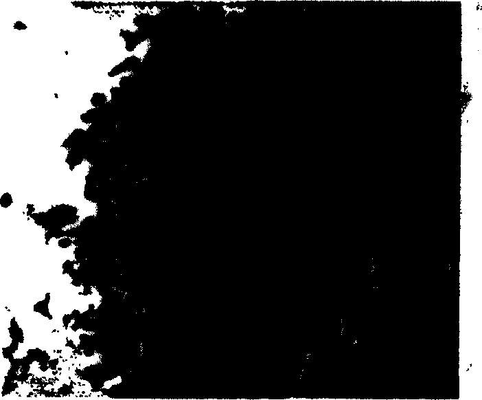 Method for separating and purifying stem cell of skin epidemis