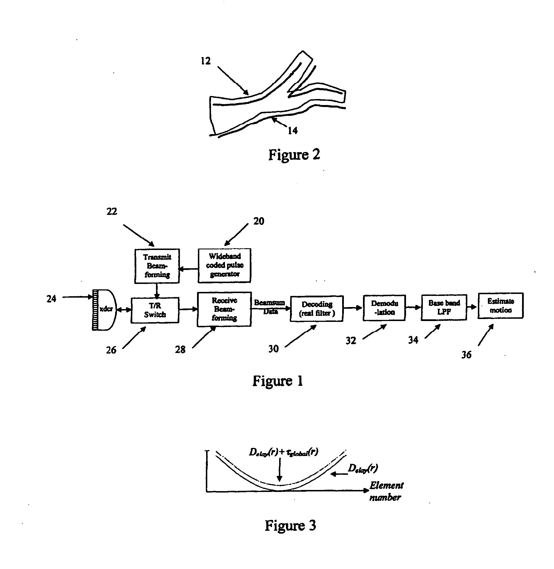 Ultrasound diagnostic flow imaging with coded excitation