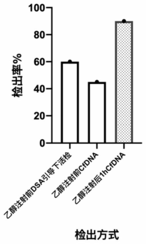 Non-invasive detection method and device for arteriovenous malformation and related diseases