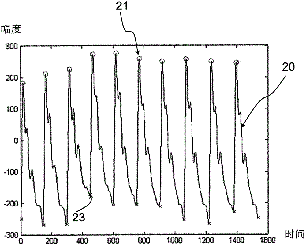 Extraction of Characteristic Parameters of Pulse Wave