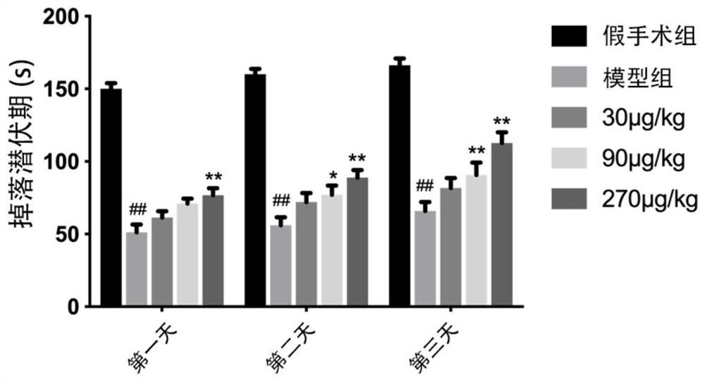 Application of TIMP-1 in preparation of medicine for preventing or treating traumatic brain injury