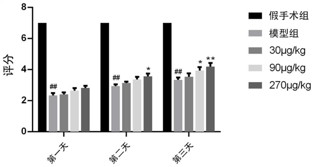 Application of TIMP-1 in preparation of medicine for preventing or treating traumatic brain injury