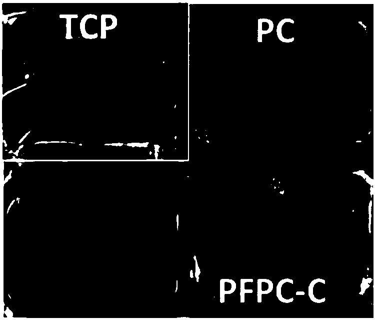 Functional guidance muscle tissue repair membrane and preparation method and application thereof